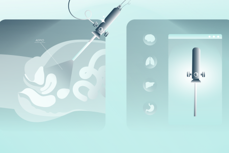 Thumbnail for the page titled: ΛΑΠΑΡΟΣΚΟΠΙΚΗ ΧΕΙΡΟΥΡΓΙΚΗ